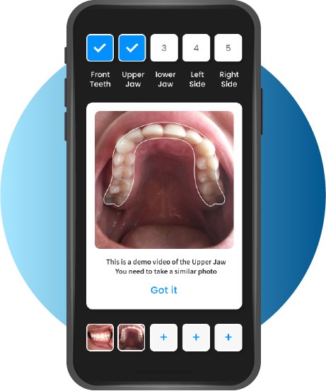 Example scan photo on phone